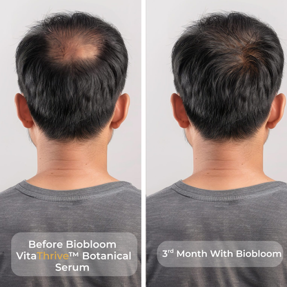 VitaThrive™ Hair Density Serum