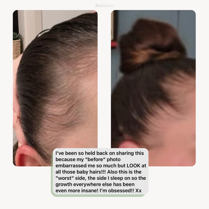 VitaThrive™ Hair Density Serum