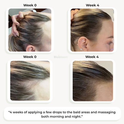 VitaThrive™ Hair Density Serum