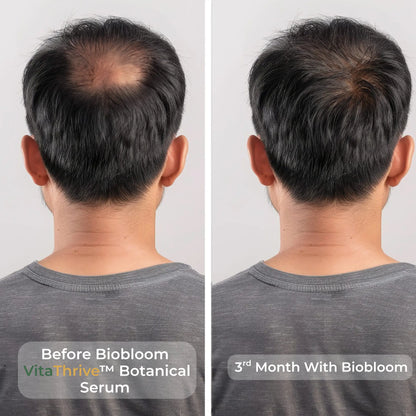 VitaThrive™ Hair Density Serum