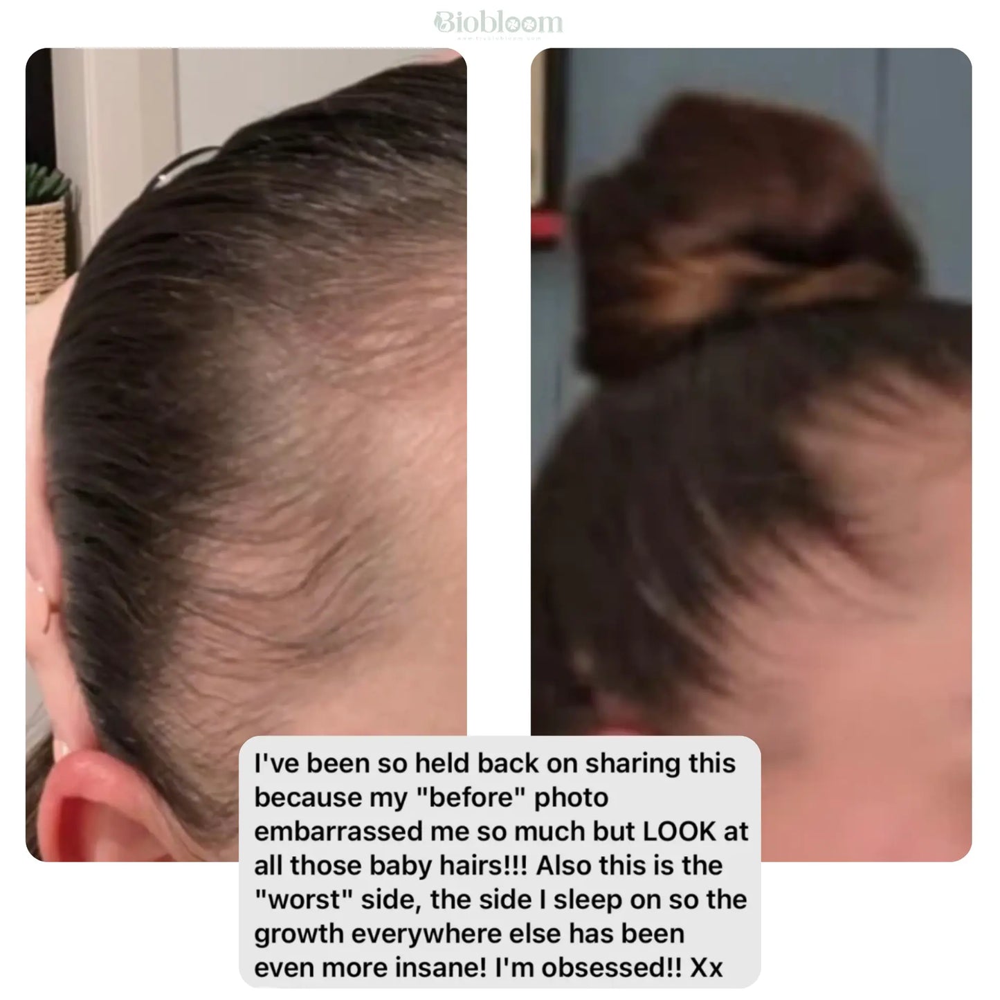 VitaThrive™ Hair Density Serum