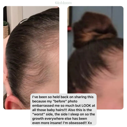 VitaThrive™ Hair Density Serum