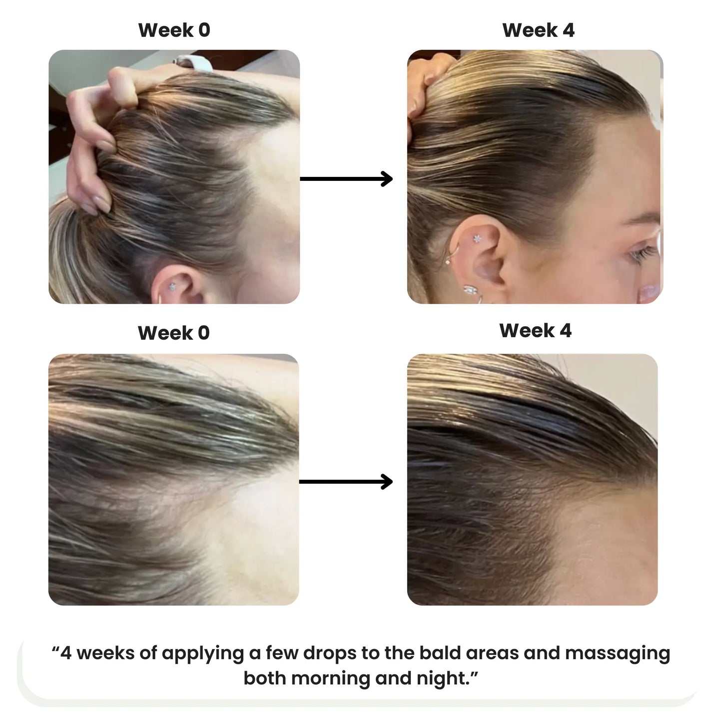 VitaThrive™ Hair Density Serum